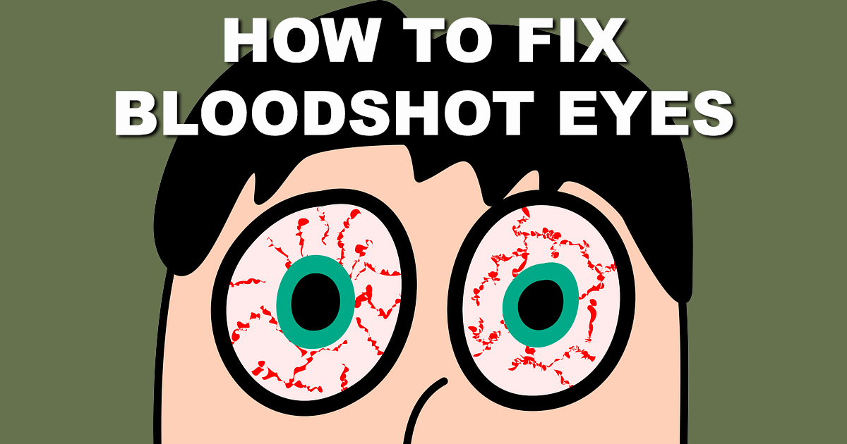 How to get Rid of Bloodshot Eyes and other Home Remedies